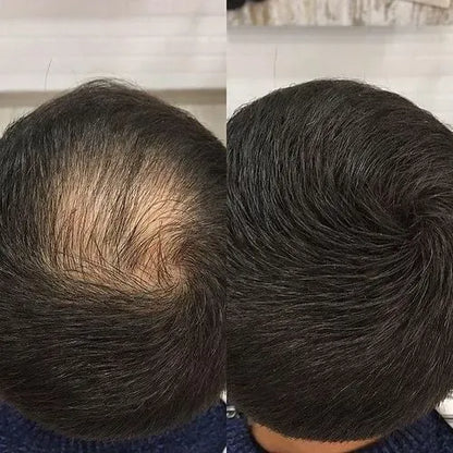 Toppik Fibras Capilares